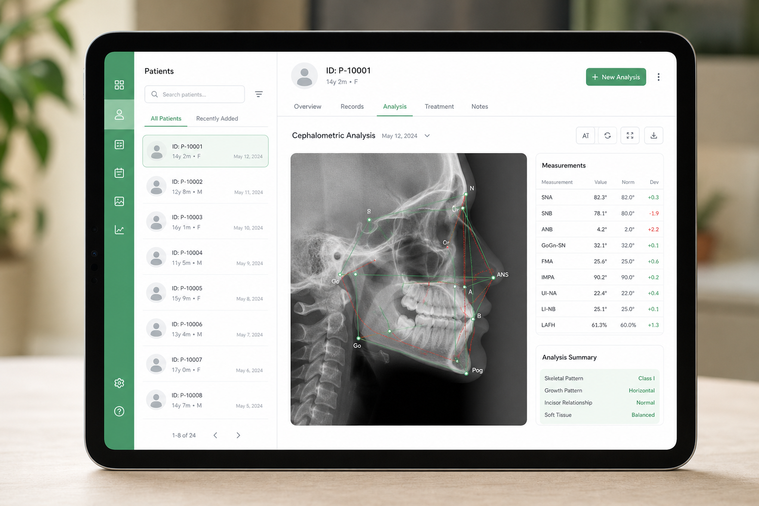 Interfaz de la calculadora ortodóncica CephCalc con tabla de cálculos
