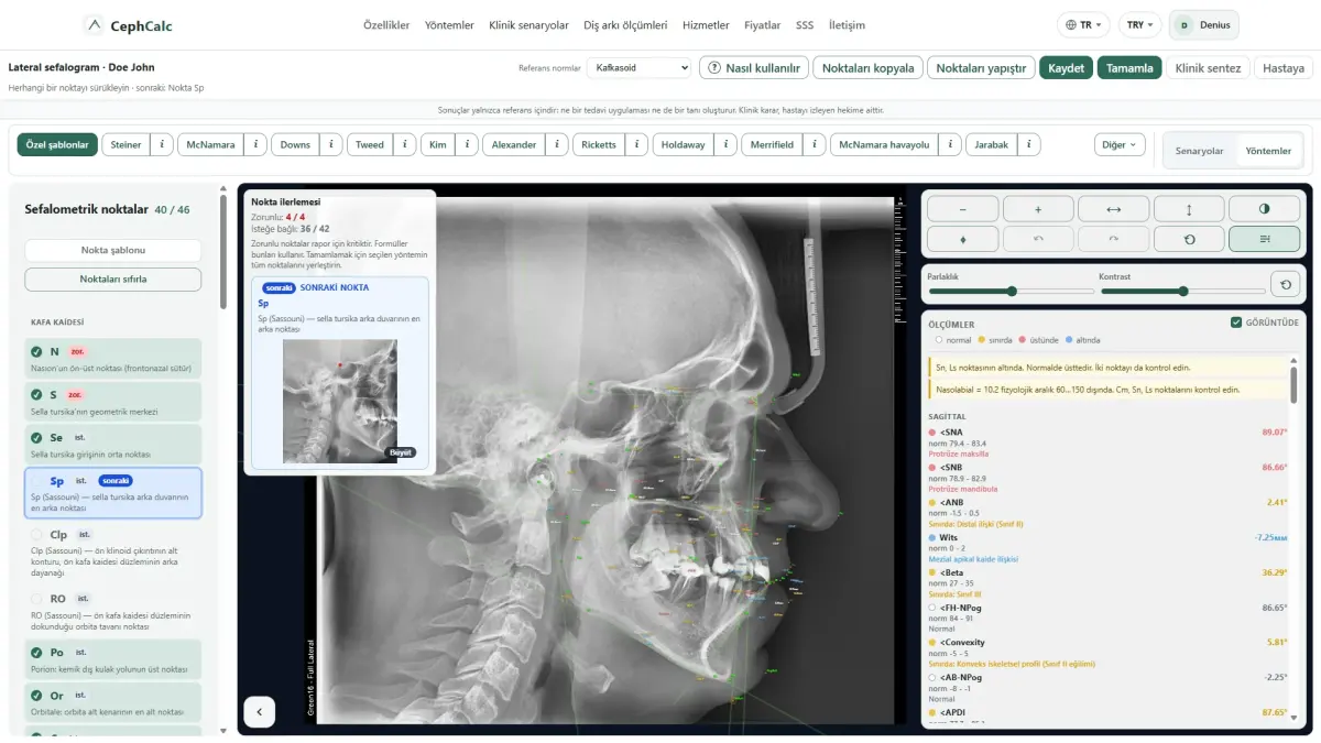 Lateral sefalogram