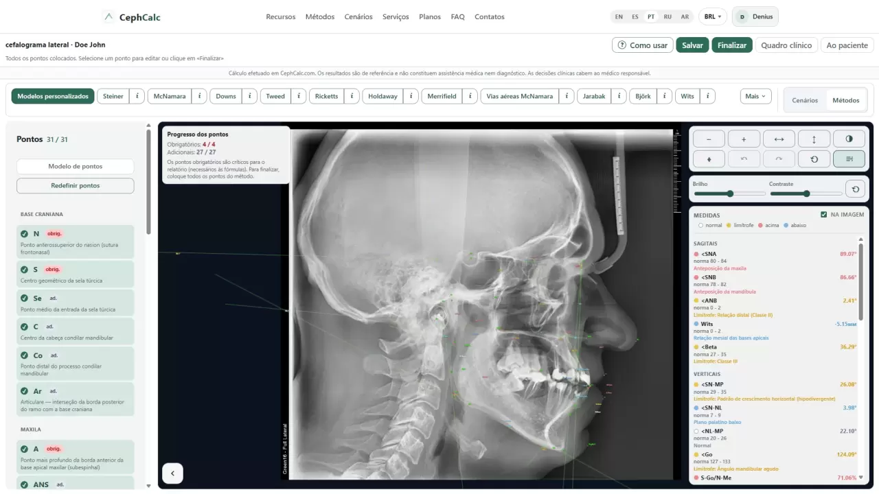 CephCalc — radiografia cefalométrica lateral e consultório do paciente