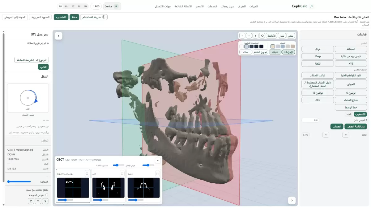 تحليل 3D