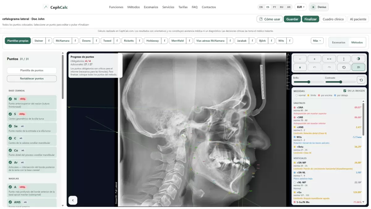 radiografía cefálica lateral
