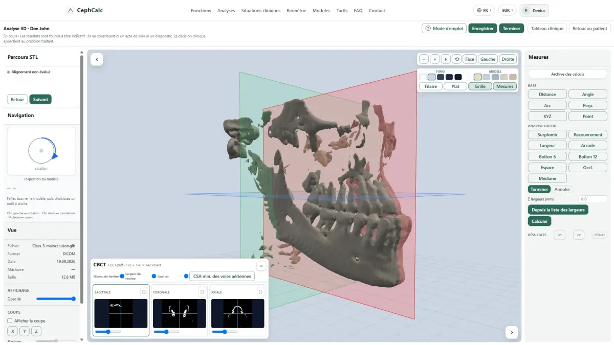 Analyse 3D