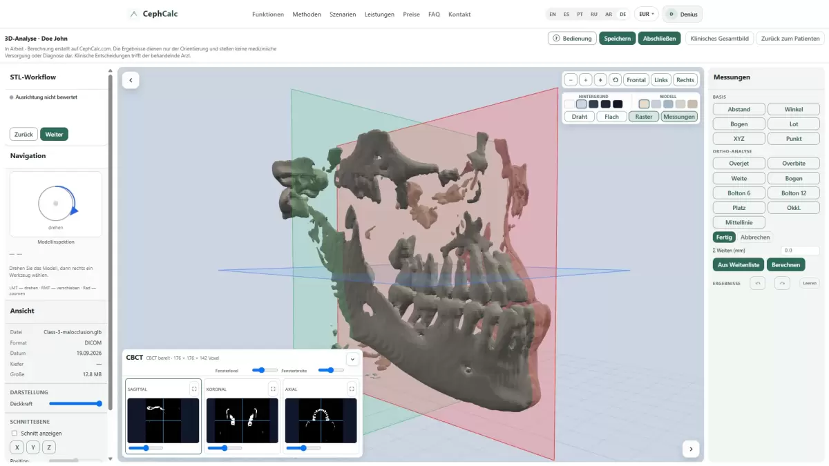 3D-Analyse