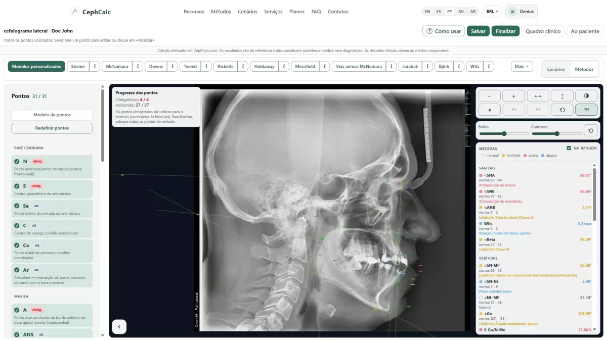radiografia cefalométrica lateral