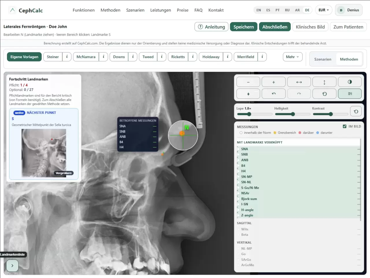 Workflow im Browser