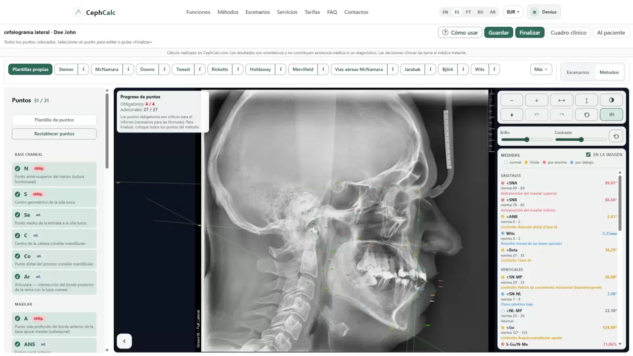 CephCalc — radiografía cefálica lateral y ficha del paciente