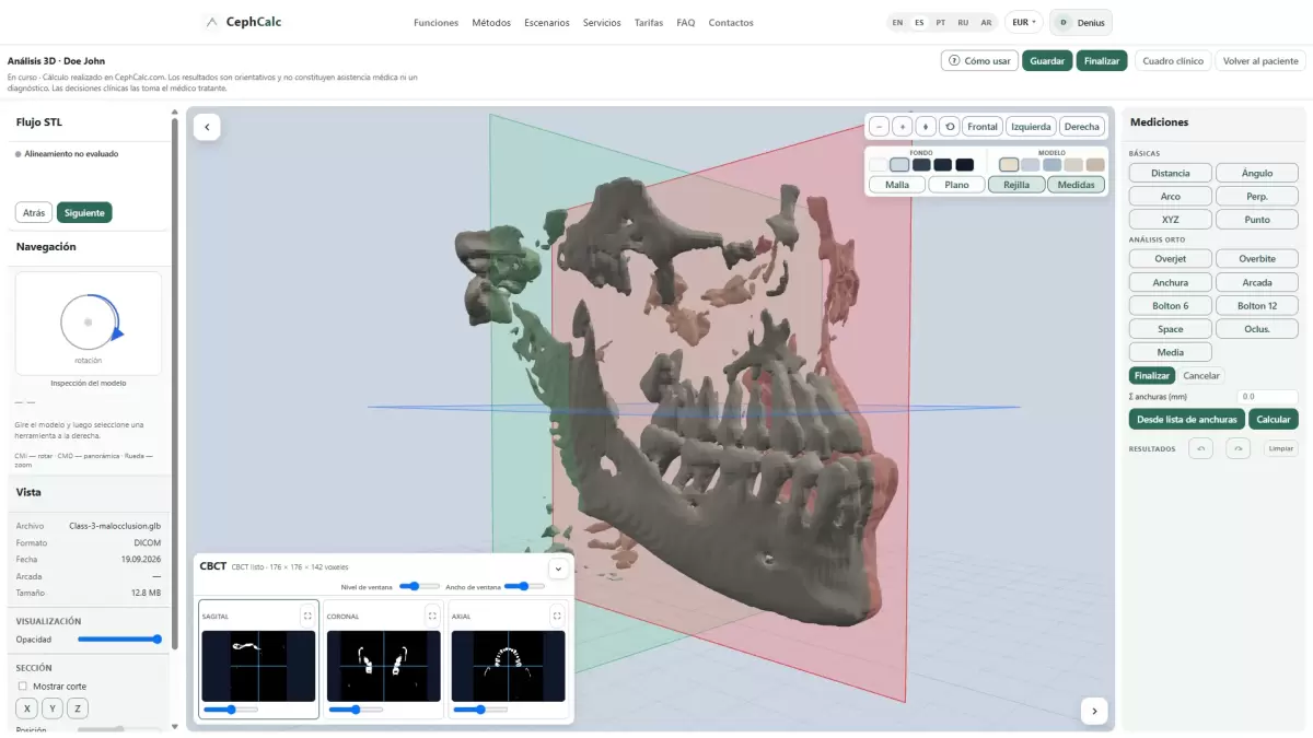 Análisis 3D